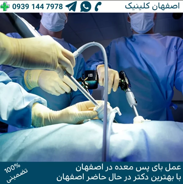 عمل بای پس معده در اصفهان
