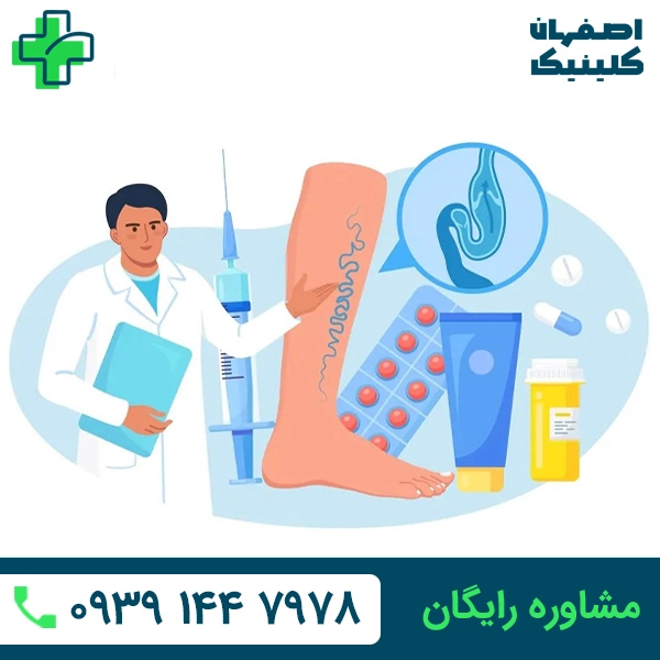 درمان واریس با لیزر در اصفهان