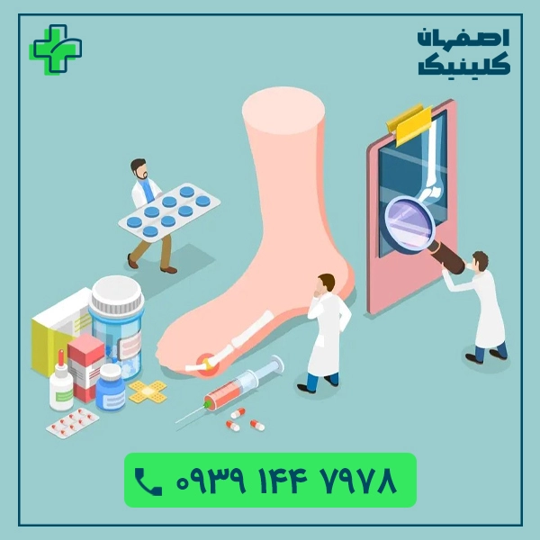 زخم دیابتی در اصفهان