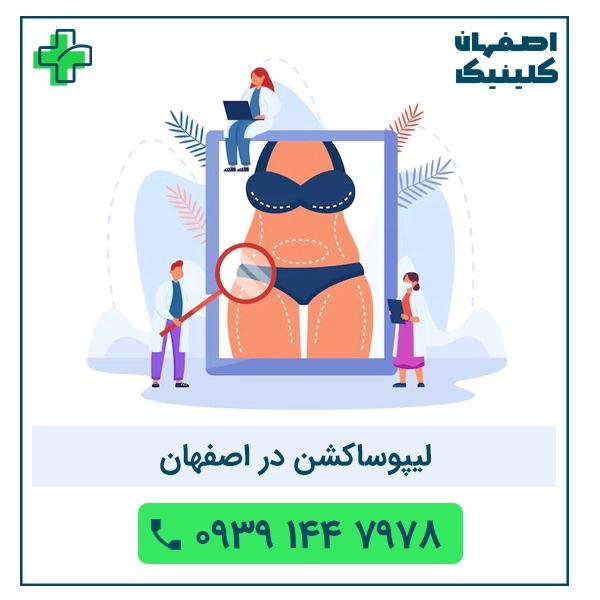 خدمات آزمایش در منزل اصفهان: راحتی و سلامت در یکقدمی شما لیپوساکشن در اصفهان